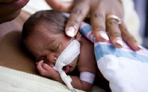 Baby dies as doctor cuts oxygen supply over nonpayment of GHS 533 bill